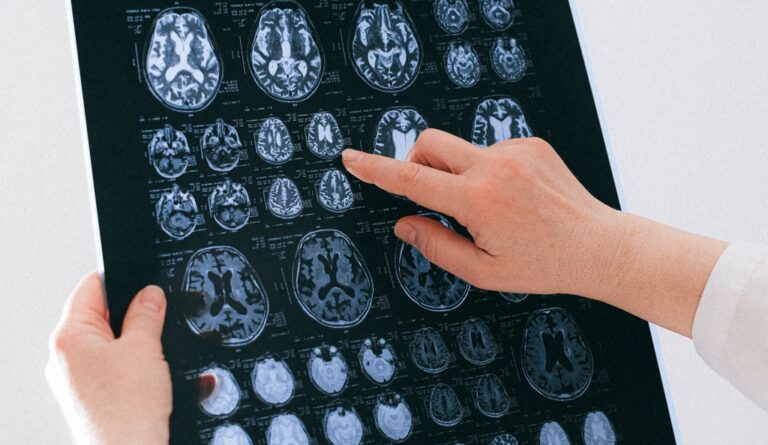 Traumatic Brain Injury Attorney